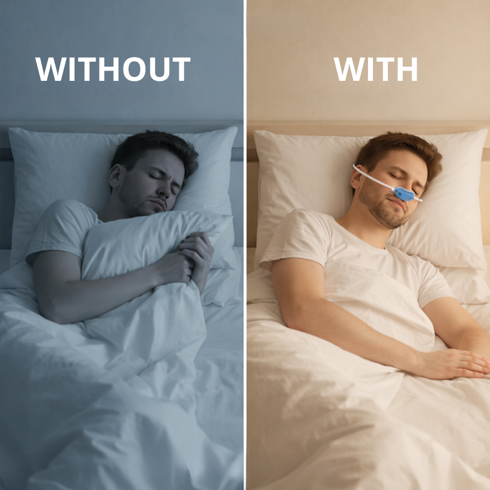 SleepEase Anti-Snoring Device